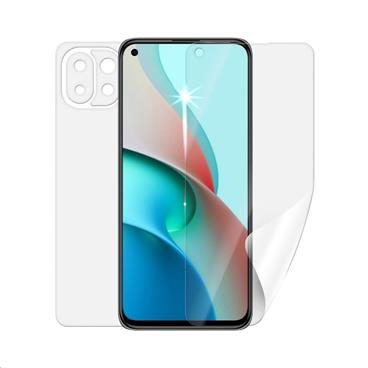 Screenshield fólie na celé tělo pro XIAOMI Mi 11 Lite