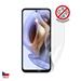 Screenshield fólie na displej Anti-Bacteria pro MOTOROLA Moto G31 XT2173